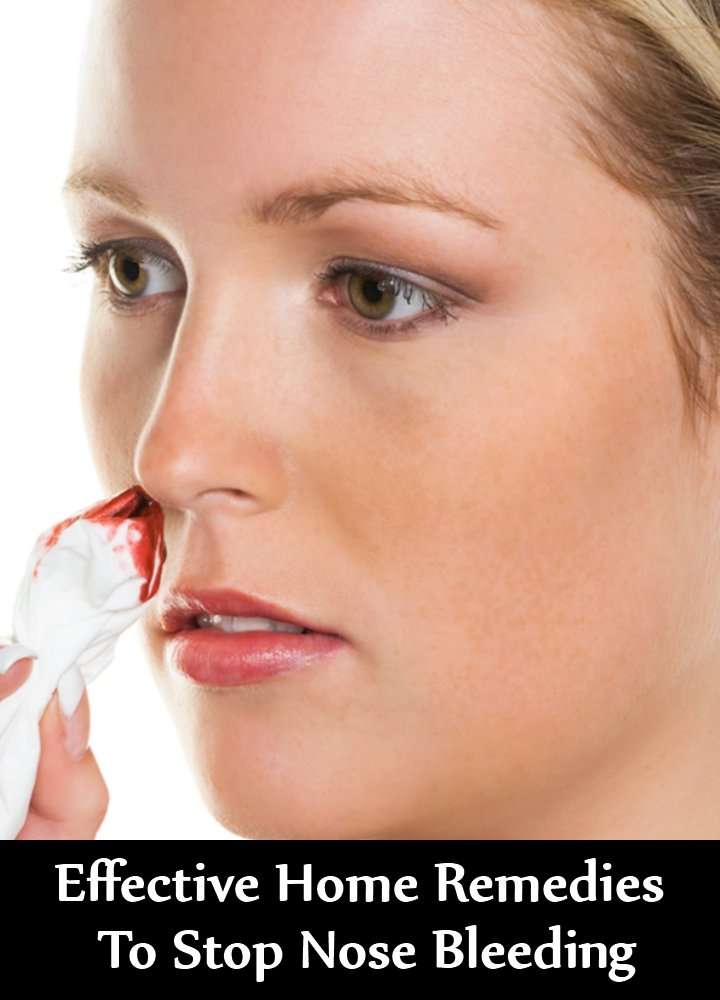 10 Effective Home Remedies To Stop Nose Bleeding â Natural ...