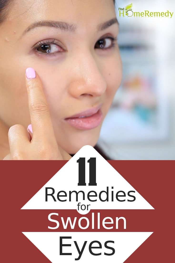 11 Home Remedies For Swollen Eyes