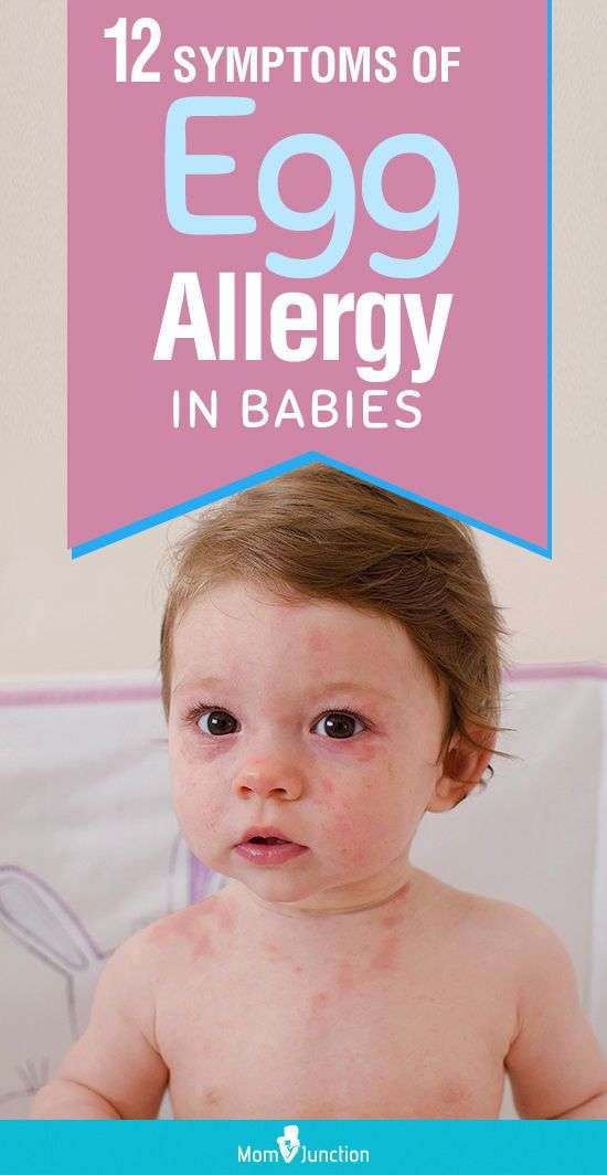 12 Symptoms Of Egg Allergy In Babies And Their Treatment ...
