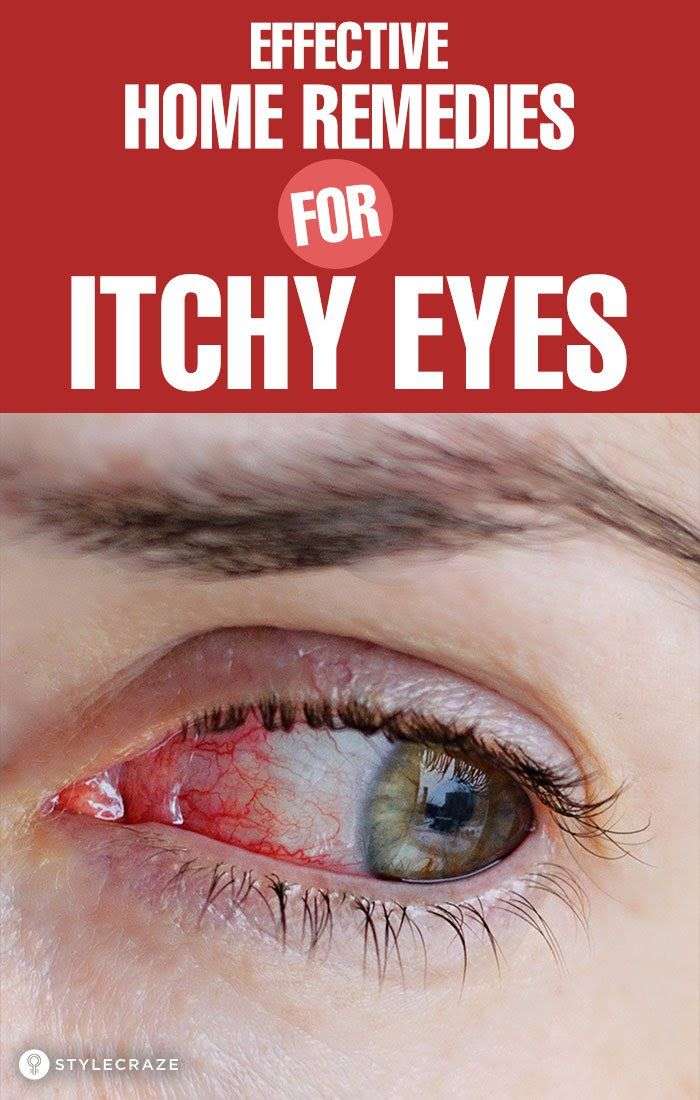 13 Effective Home Remedies For Itchy Eyes + Causes And ...