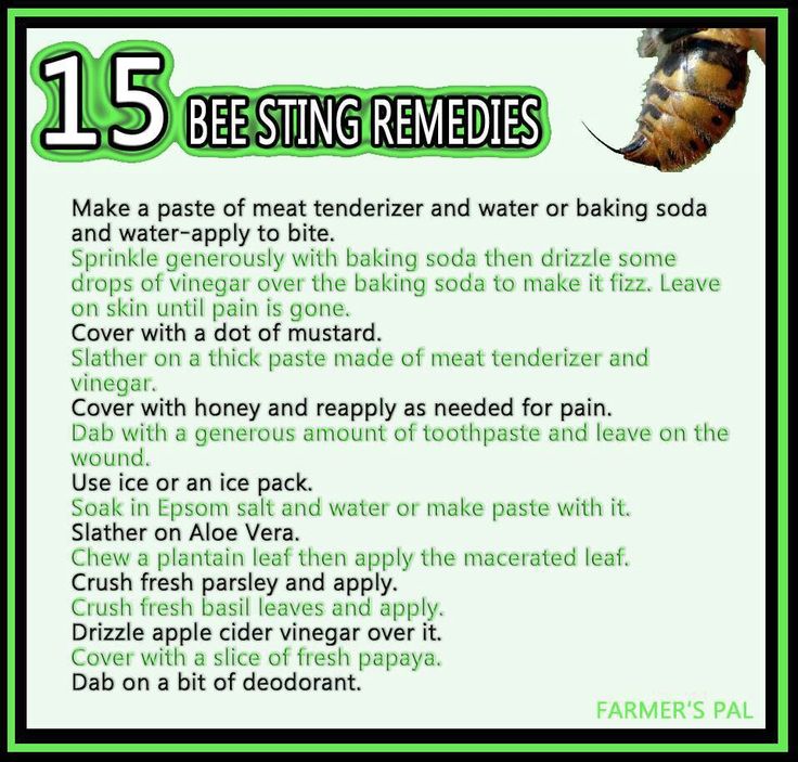 15 Bee Sting Remedies (With images)