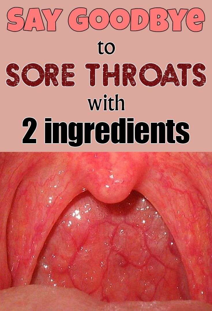 17+ best images about Health Cold &  Flu on Pinterest