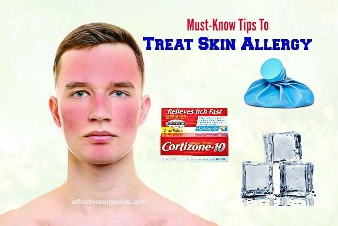 20 Effective Home Remedies For Skin Allergy In Children ...