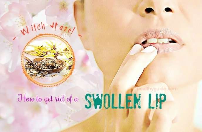 22 Tips How To Get Rid Of A Swollen Lip From A Cold Sore ...