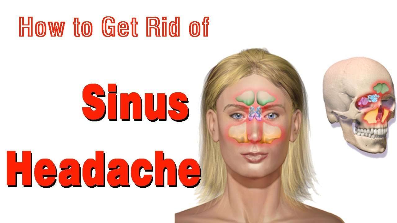 4 Effective and Easy to Use Remedies to Get Rid of a Sinus ...