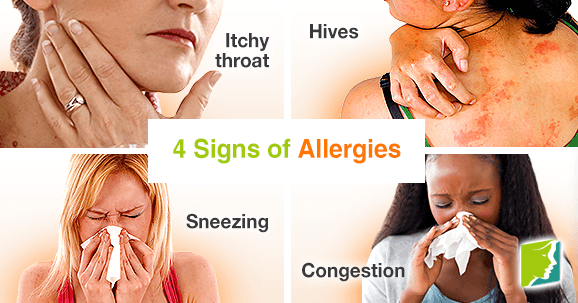4 Signs of Allergies