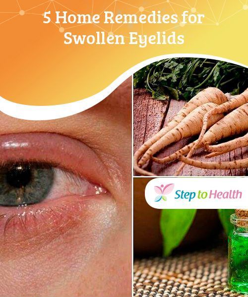 5 Home Remedies for Swollen Eyelids Both drinking and applying fennel ...