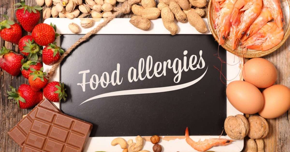 5 tips for dealing with food allergies