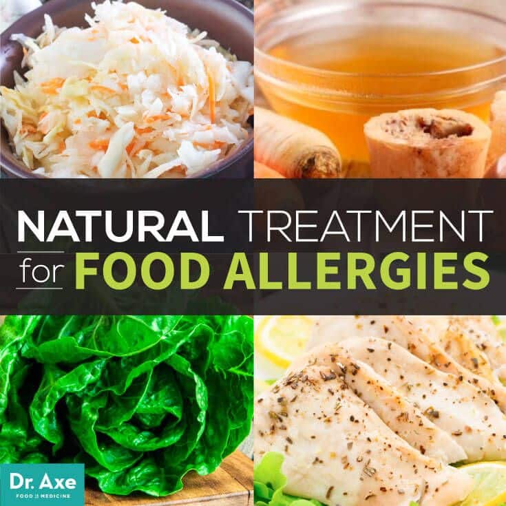 6 Natural Treatments of Food Allergies