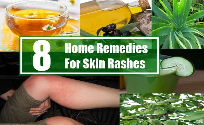 8 Home Remedies For Skin Rashes