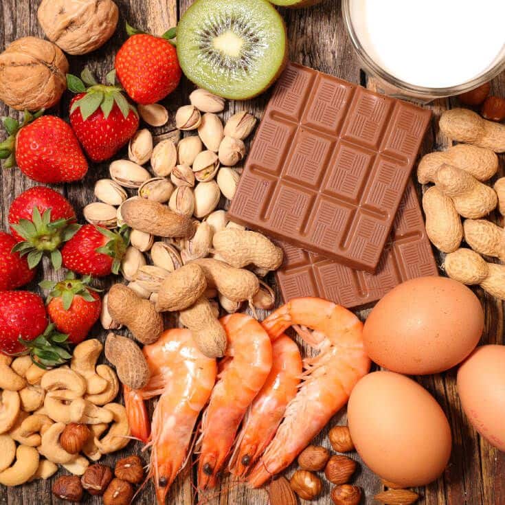 8 Popular Foods Are Responsible for 90+ Percent of Food Allergies ...