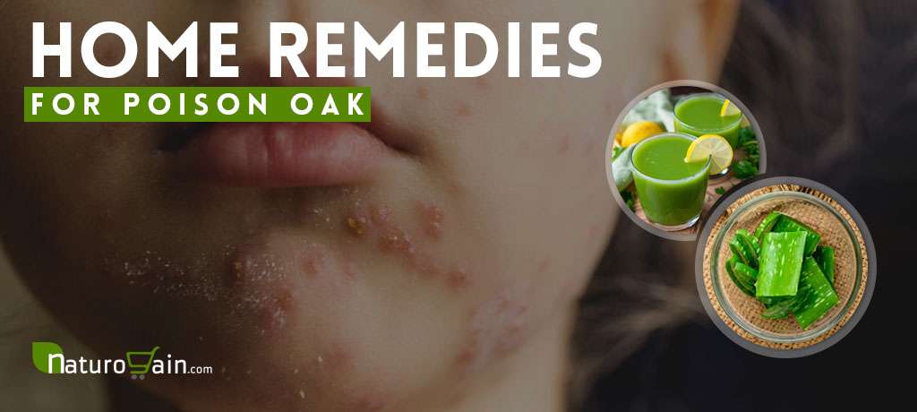 9 Best Home Remedies for Poison Oak to Prevent Allergic Reaction