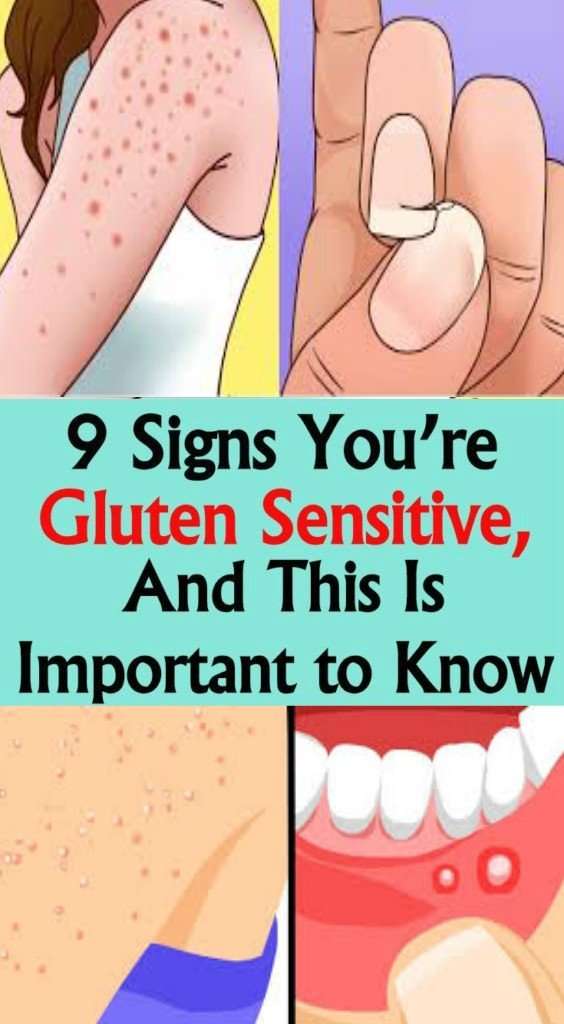 9 Signs Youre Gluten Sensitive, and This Is Important to Know