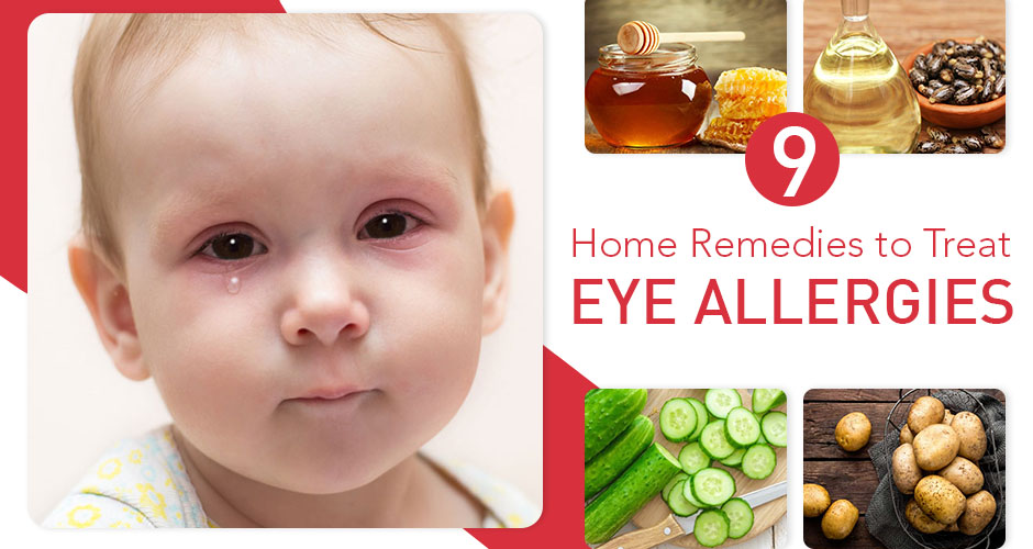 9 simple home remedies for eye allergies