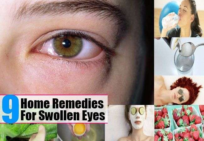9 Top Home Remedies For Swollen Eyes