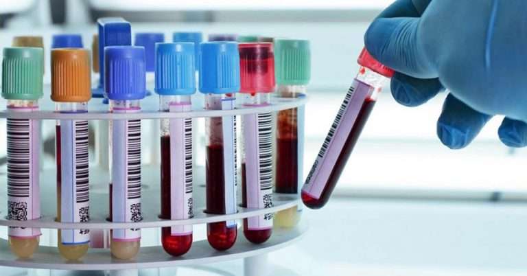 AllerGenis Lauds Study Results of New, More Accurate Blood ...