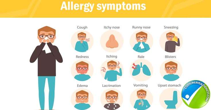 Allergies: Types, Symptoms, Causes, Risk Factor and Treatments