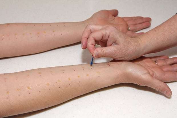 Allergy patch creators ExVivo want you to be able to do at ...