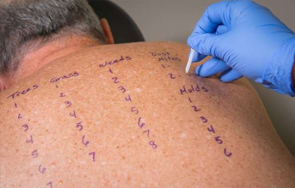 Allergy testing and desensitization. How do we test for ...