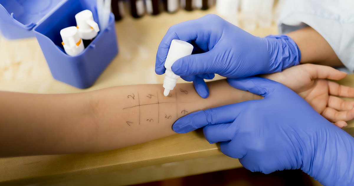 Allergy Testing: What it is and What to Expect