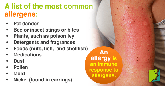An Overview of Allergies That Can Cause Itchy Skin ...