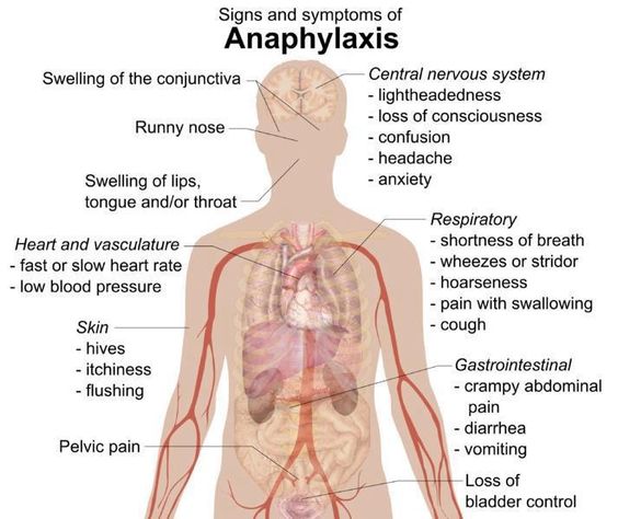 Anaphylaxis/Allergic reaction