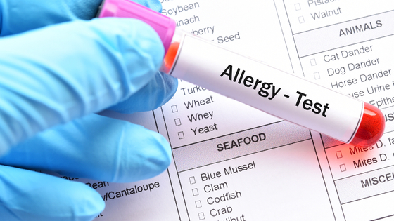 Are Food Sensitivity and Allergy Tests Reliable?