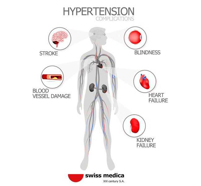 Arterial Hypertension Treatment with Stem Cells