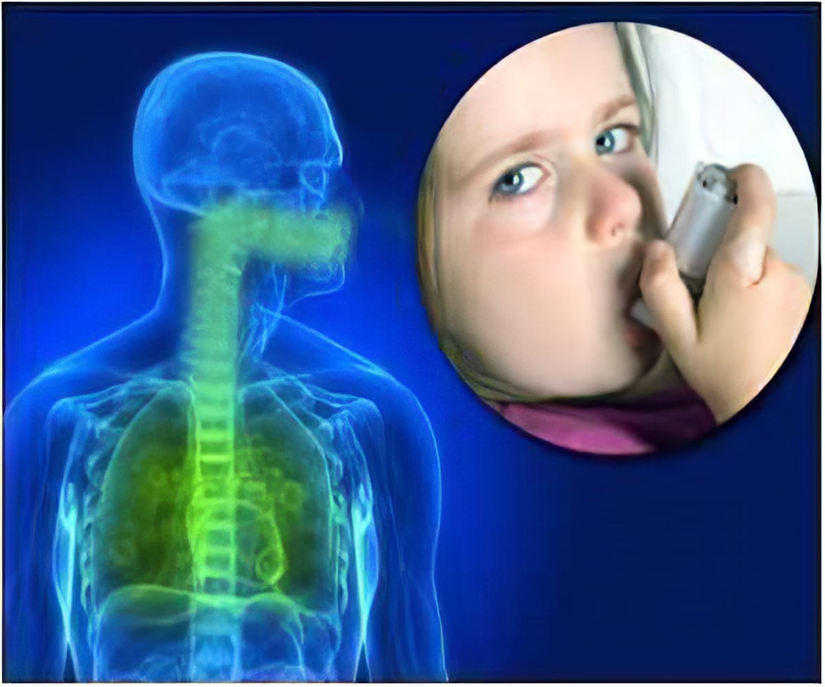 Asthma Nose Congestion