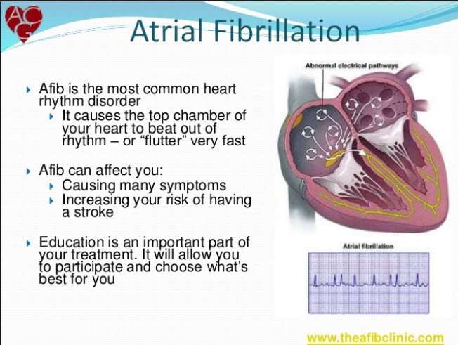 Atrial Fibrillation: What Is It, How Does It Affect Your ...