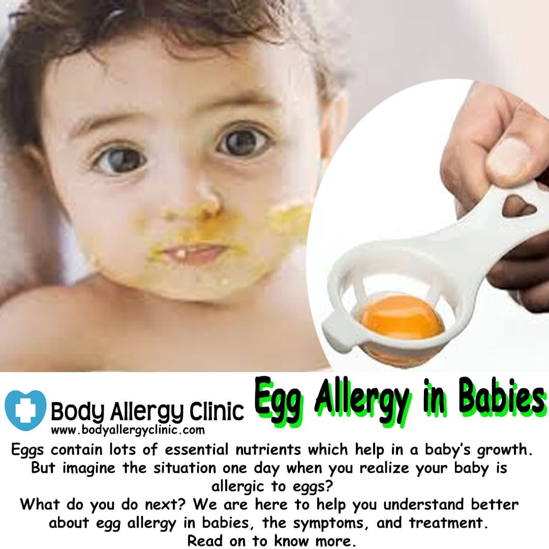 Baby Egg Allergy Symptoms