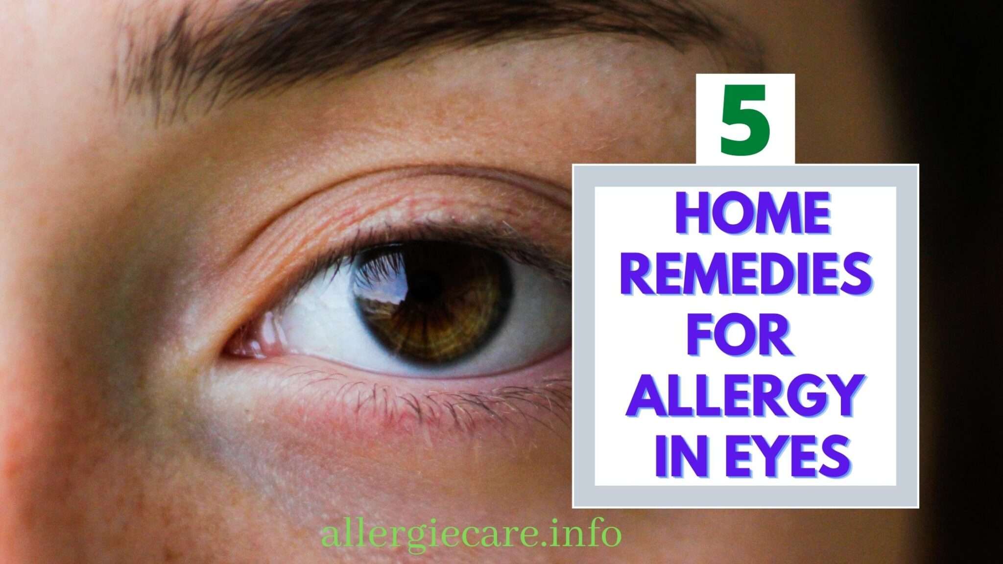 Best 5 home remedies for allergy in eyes