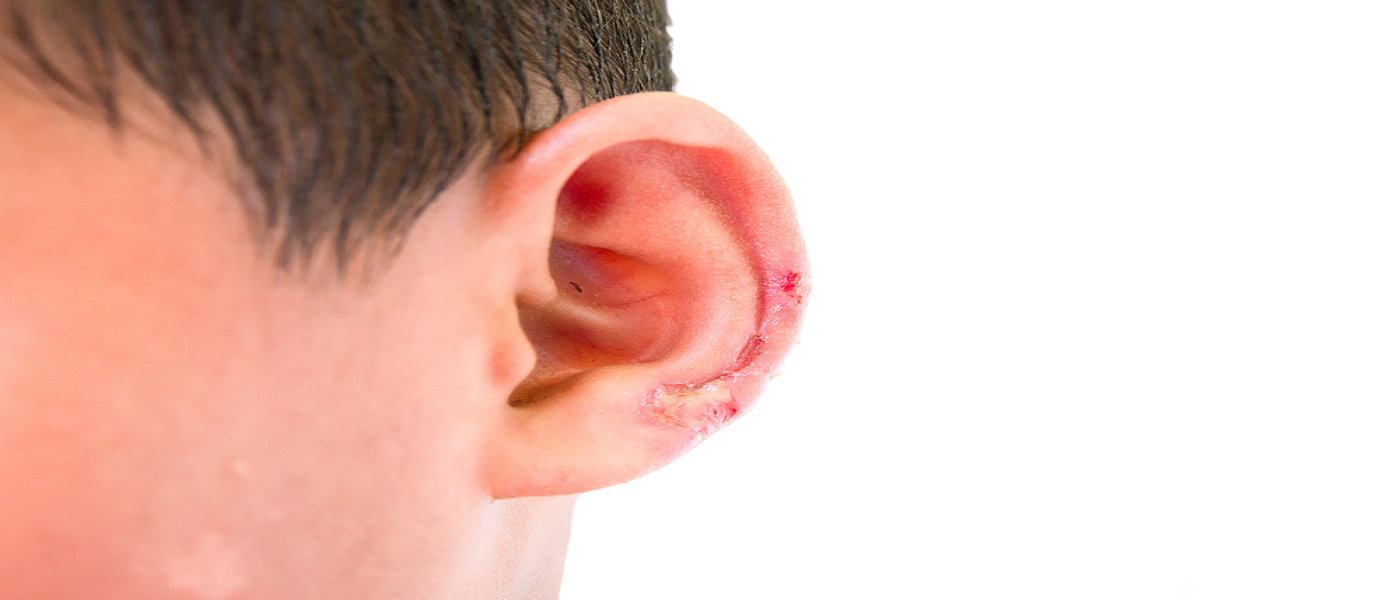Can Allergies Affect Your Ears?