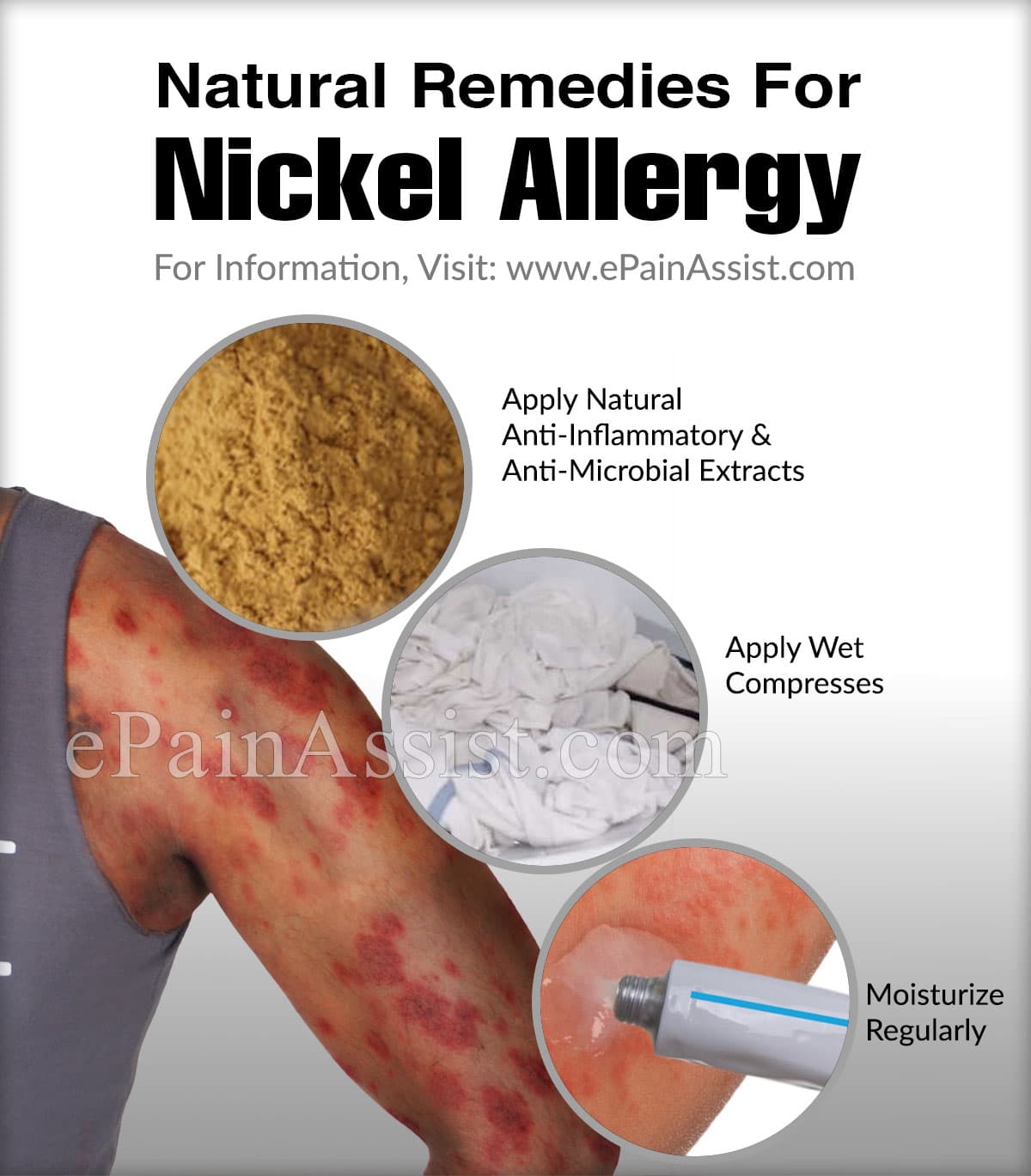 Can Nickel Allergy Go Away On Its Own &  What Are It
