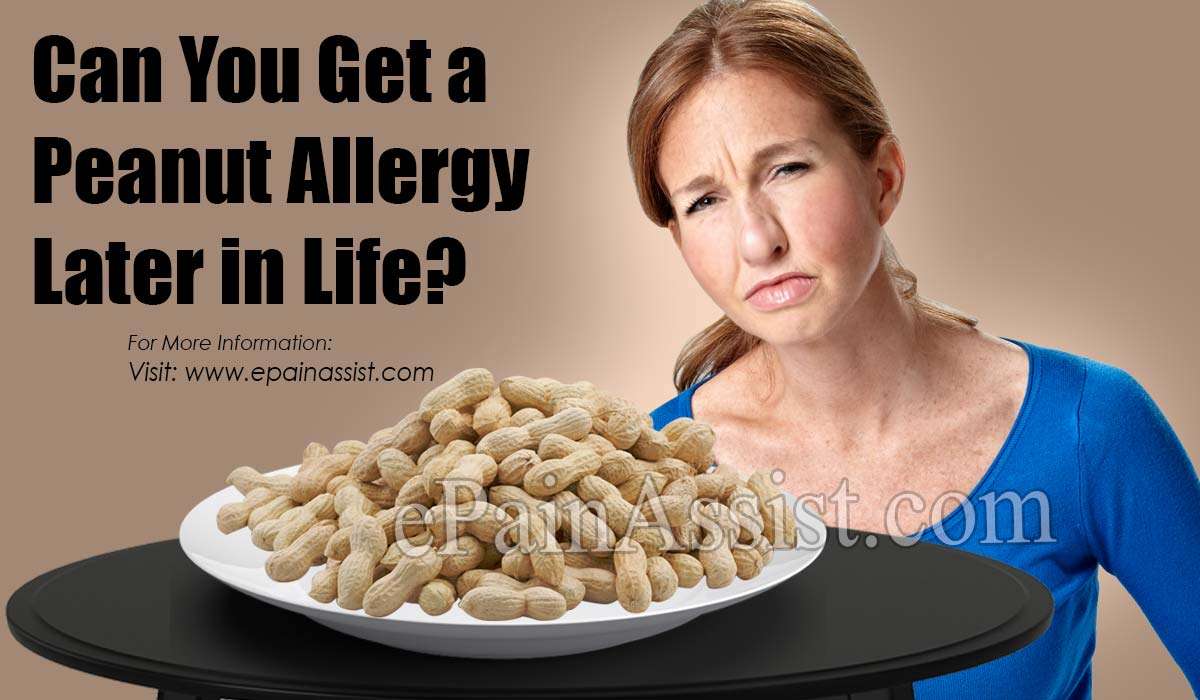 Can You Get a Peanut Allergy Later in Life?