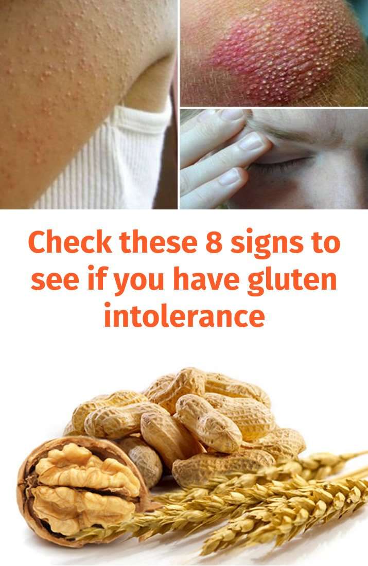 Check these 8 signs to see if you have gluten intolerance ...