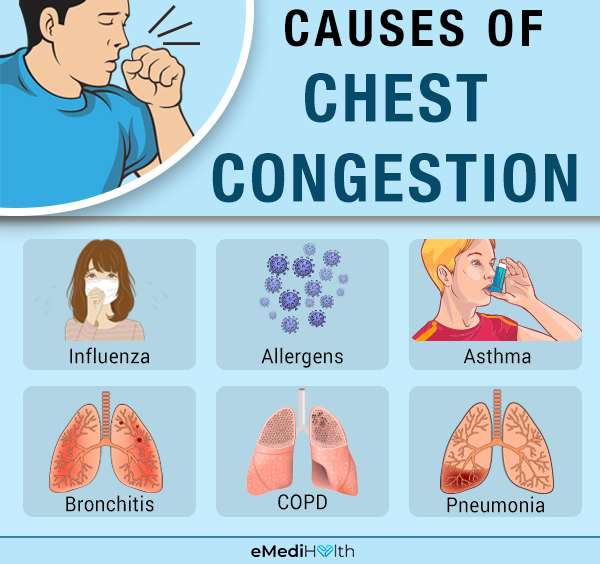 Chest Congestion: Causes, Symptoms, and Treatments