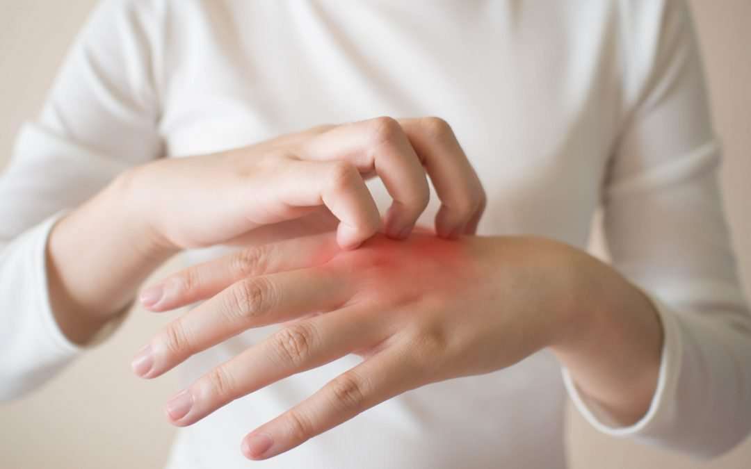Common Causes of Itchy Skin