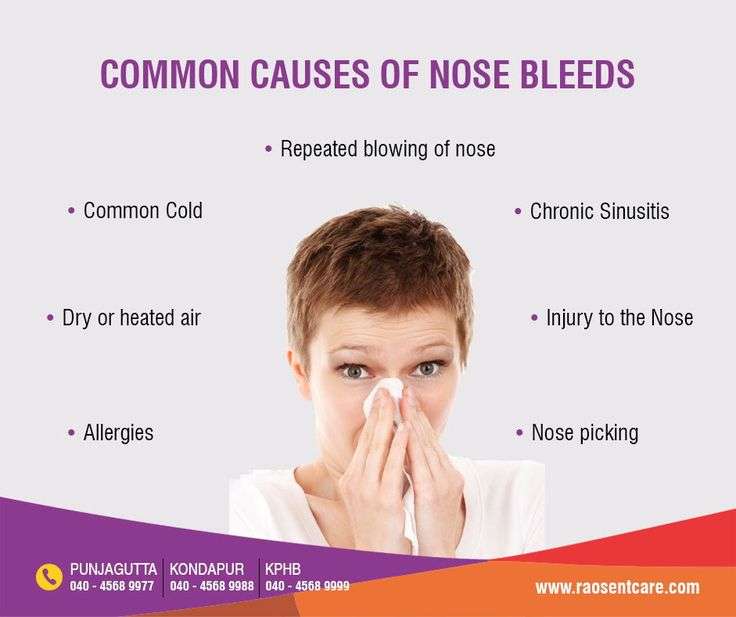 Common Causes of Nose Bleed https://raosentcare.com ...