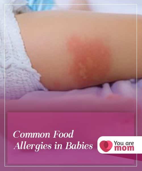 Common Food Allergies in Babies