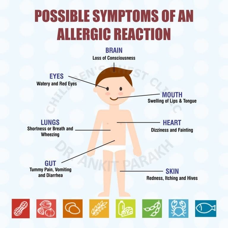 Common symptoms of allergy in children