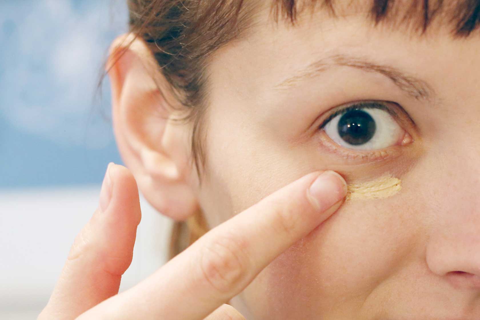 Dark Circles under Your Eyes: Causes and Treatments