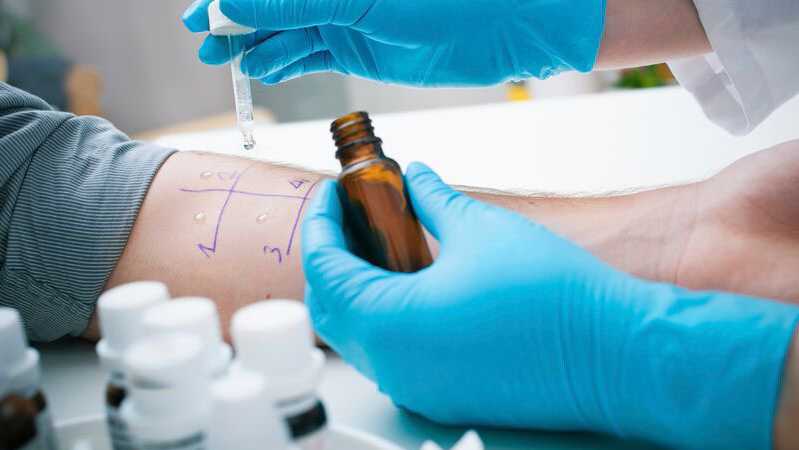 designsolutionsofpittsburgh: How Do You Take An Allergy Test