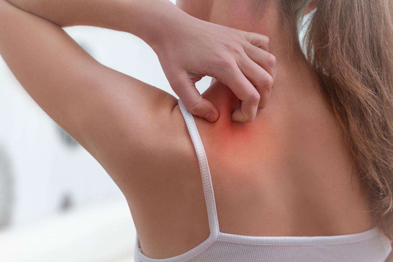 Do seasonal allergies cause itchy skin?