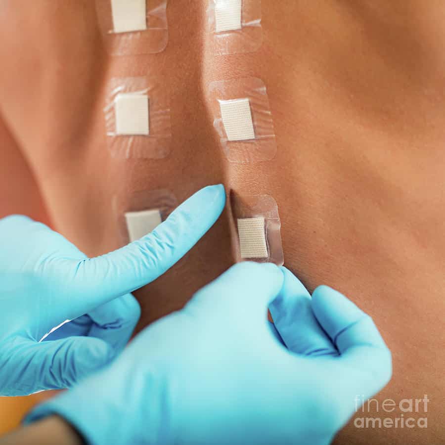 Doctor Doing Skin Allergy Test Photograph by Microgen Images/science ...