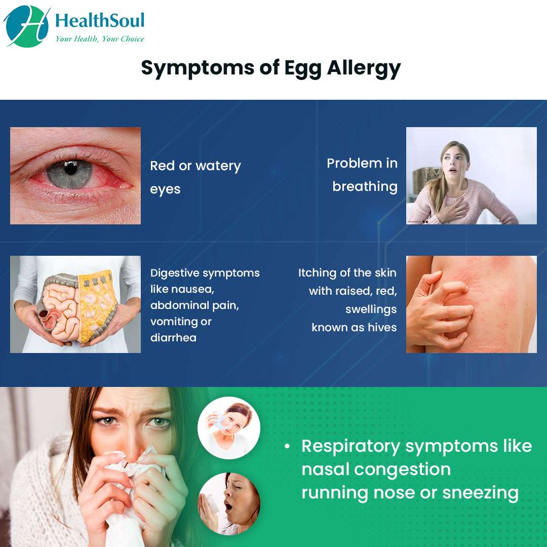 Egg Allergy: Symptoms, Causes and Management  Healthsoul