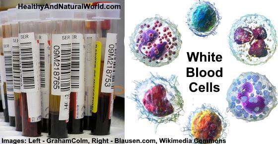 Elevated White Blood Cell (WBC) Count: Causes, Treatments ...