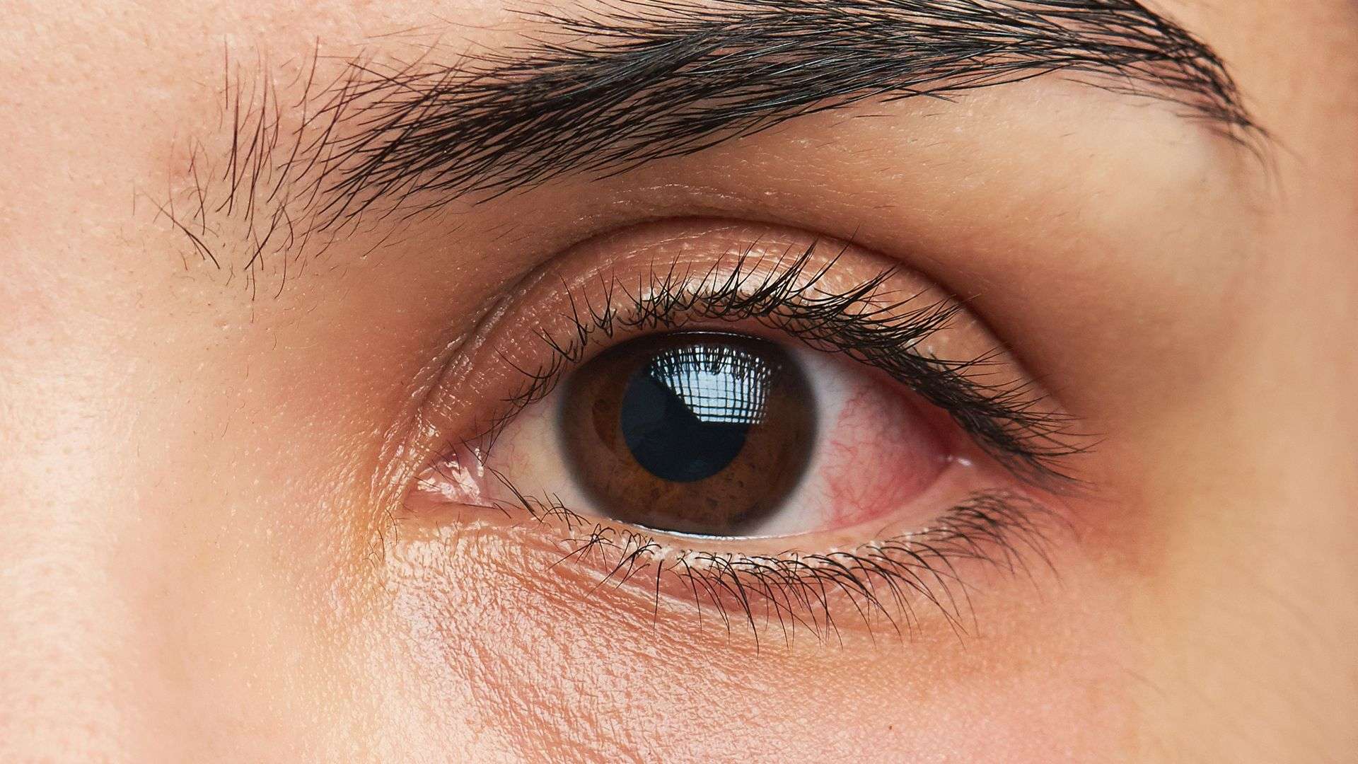 Eye Allergy Treatments
