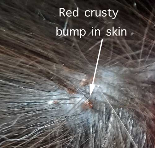 Flea Bite Allergy  feline miliary dermatitis  PoC