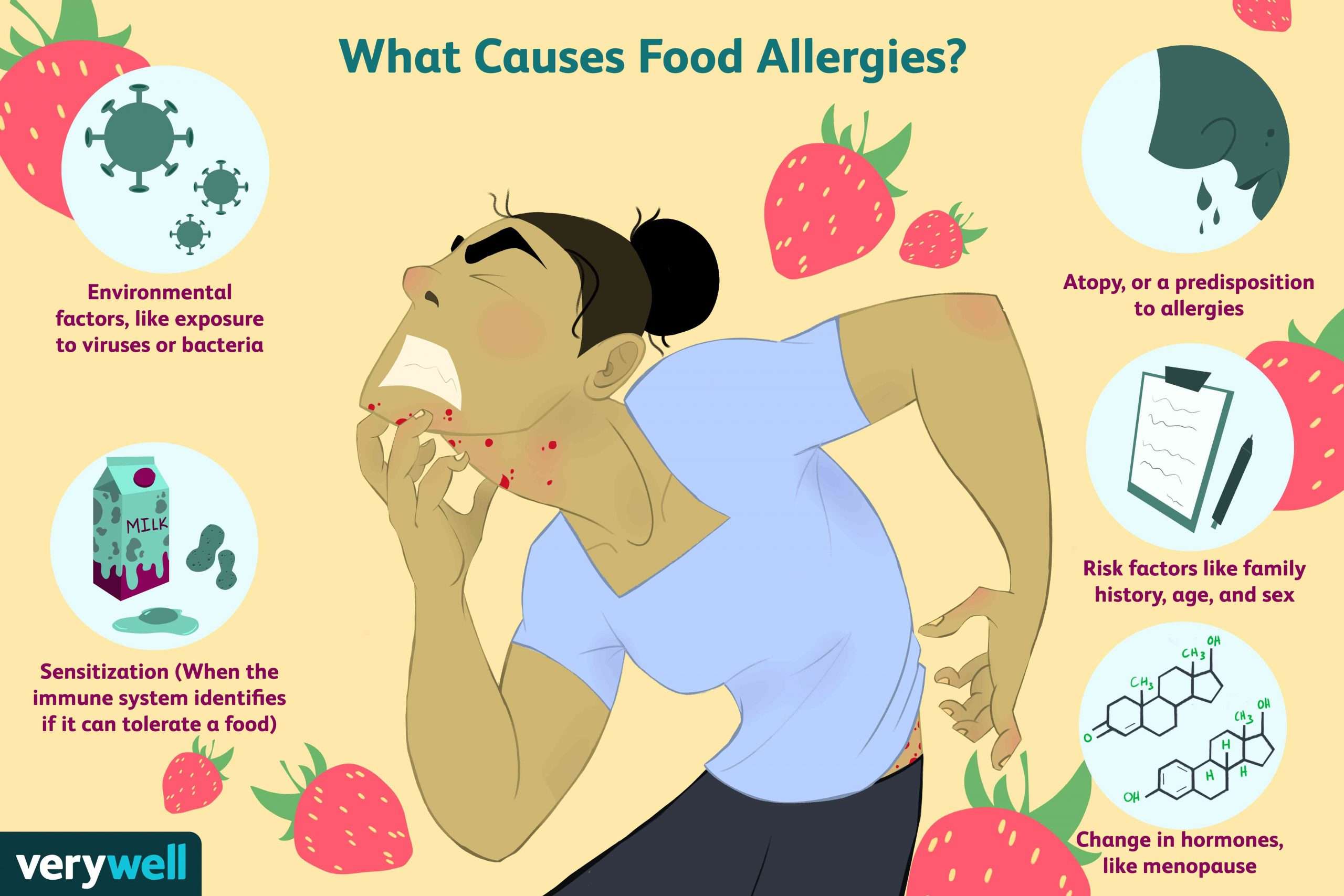 Food Allergies: Causes and Risk Factors